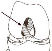 acl attachment