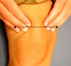 mobilising the suprapatellar region