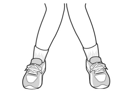 valgus deformity