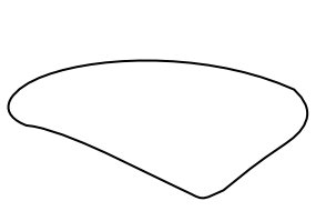 Wiberg Type 2 patella