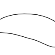 wiberg type 4 patellar dysplasia